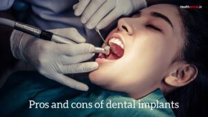 pros and cons of dental implants